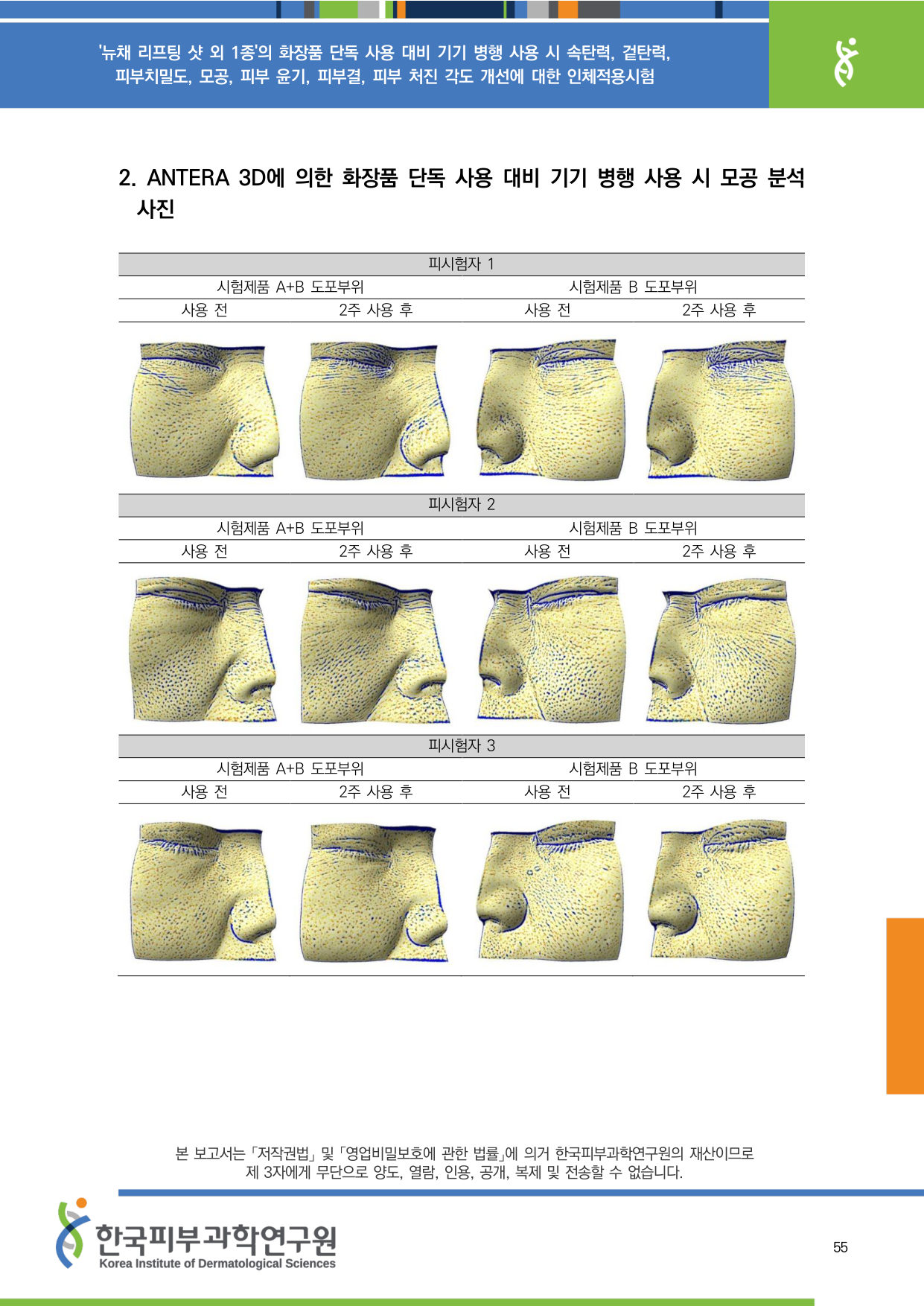 ANTERA 모공 1-3
