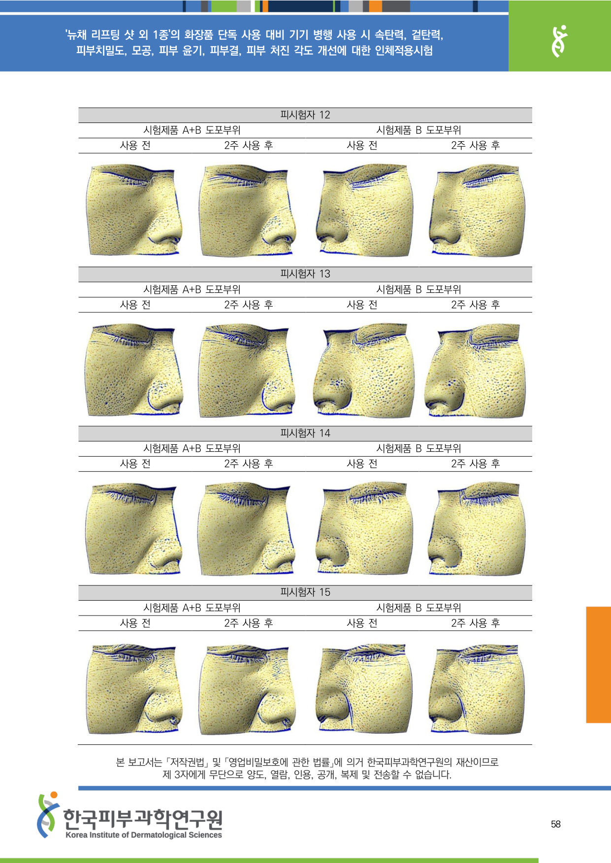 ANTERA 모공 12-15