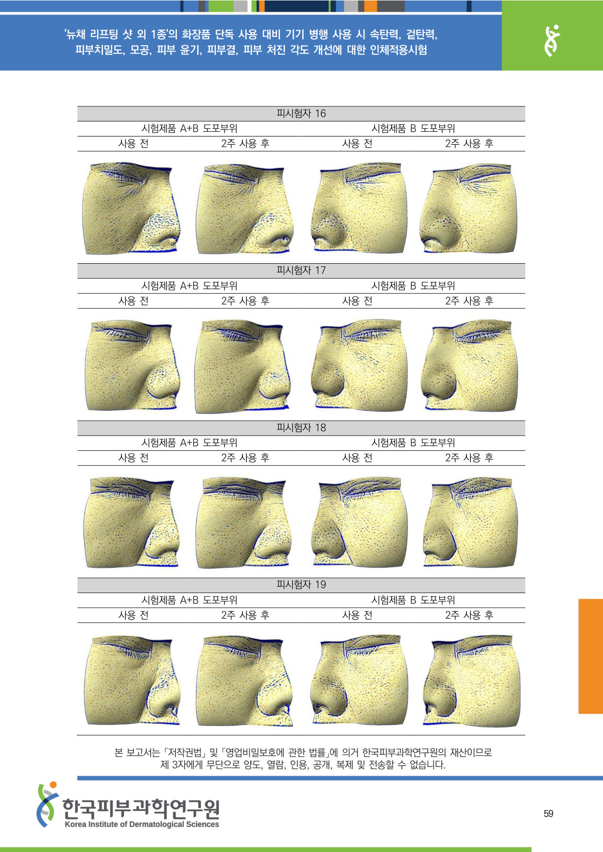 ANTERA 모공 16-19