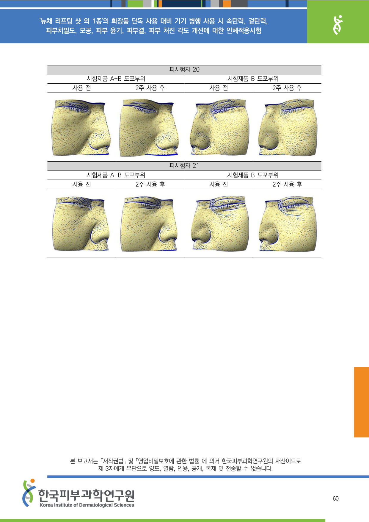 ANTERA 모공 20-21