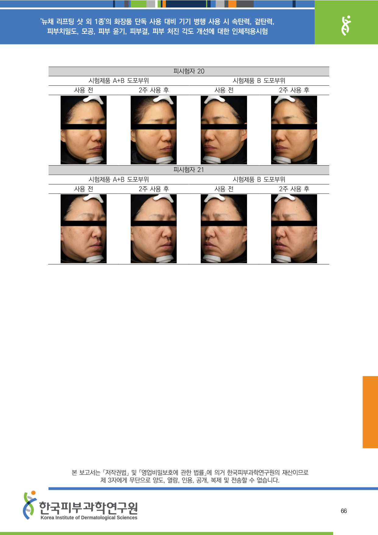 VISIA 윤기 20-21