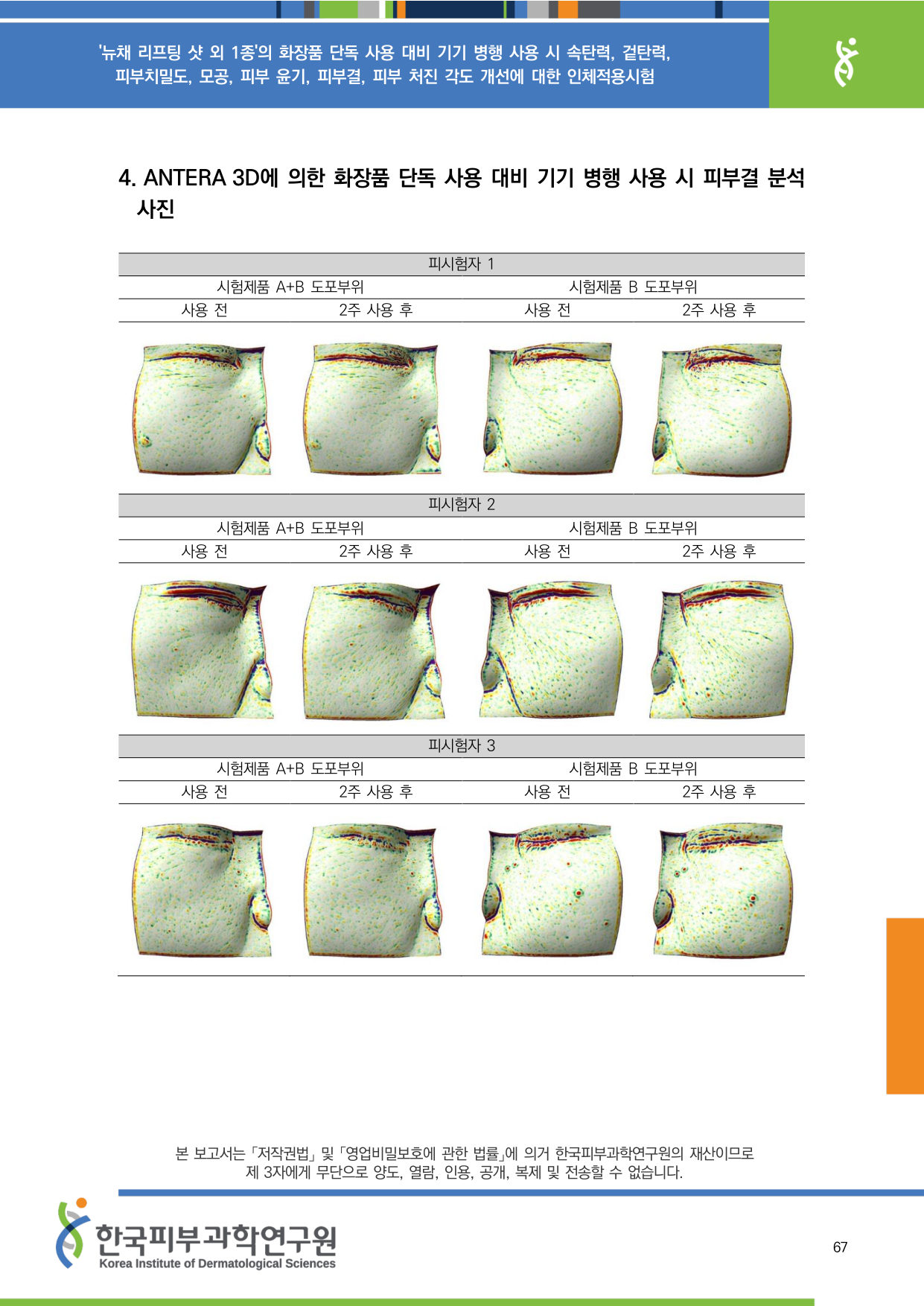 ANTERA 피부결 1-3