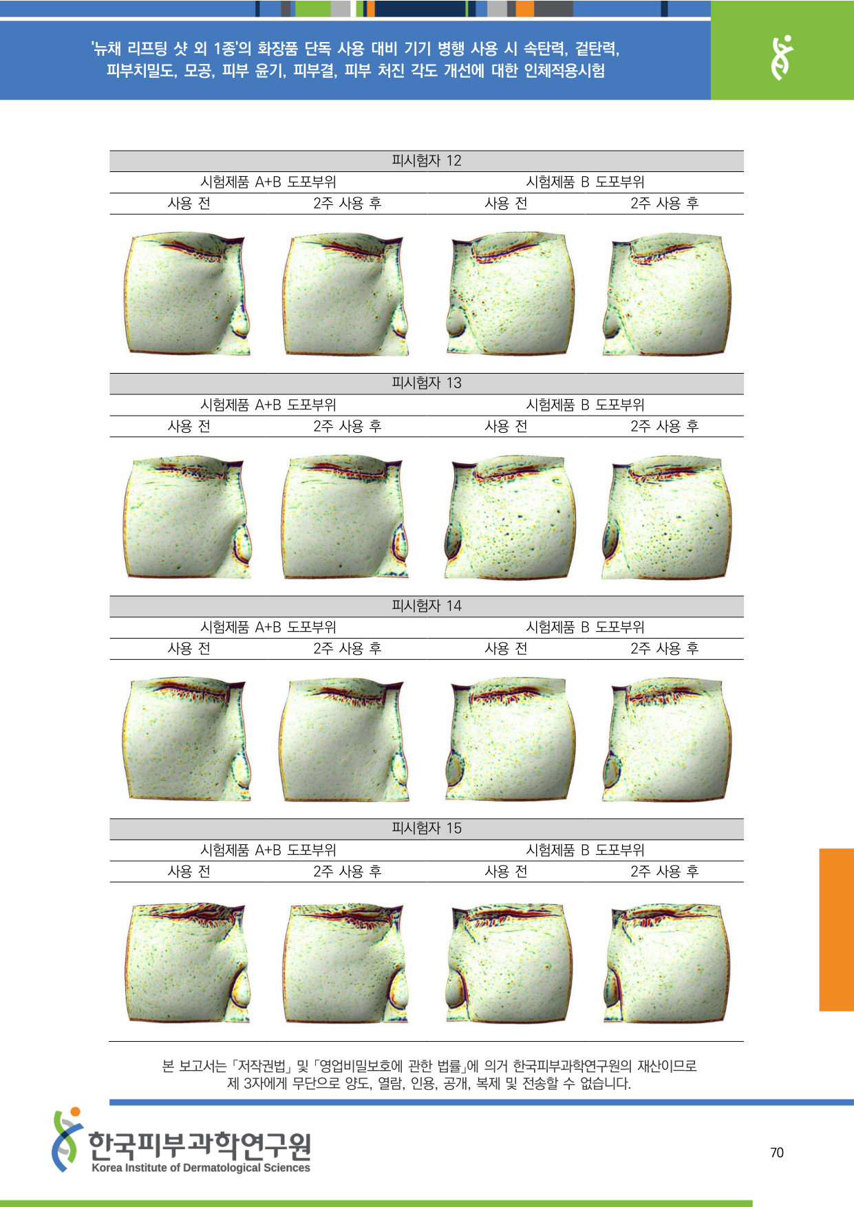 ANTERA 피부결 12-15