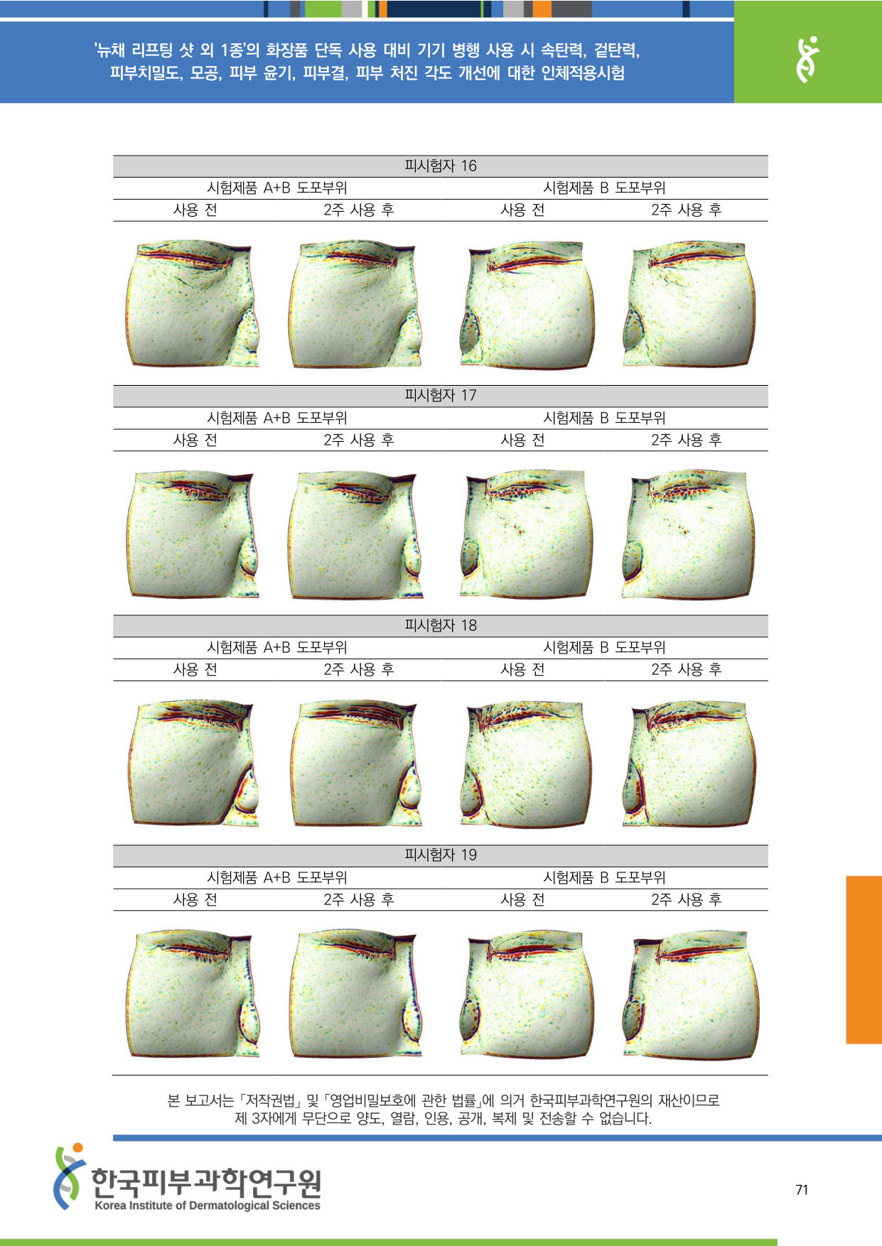 ANTERA 피부결 16-19