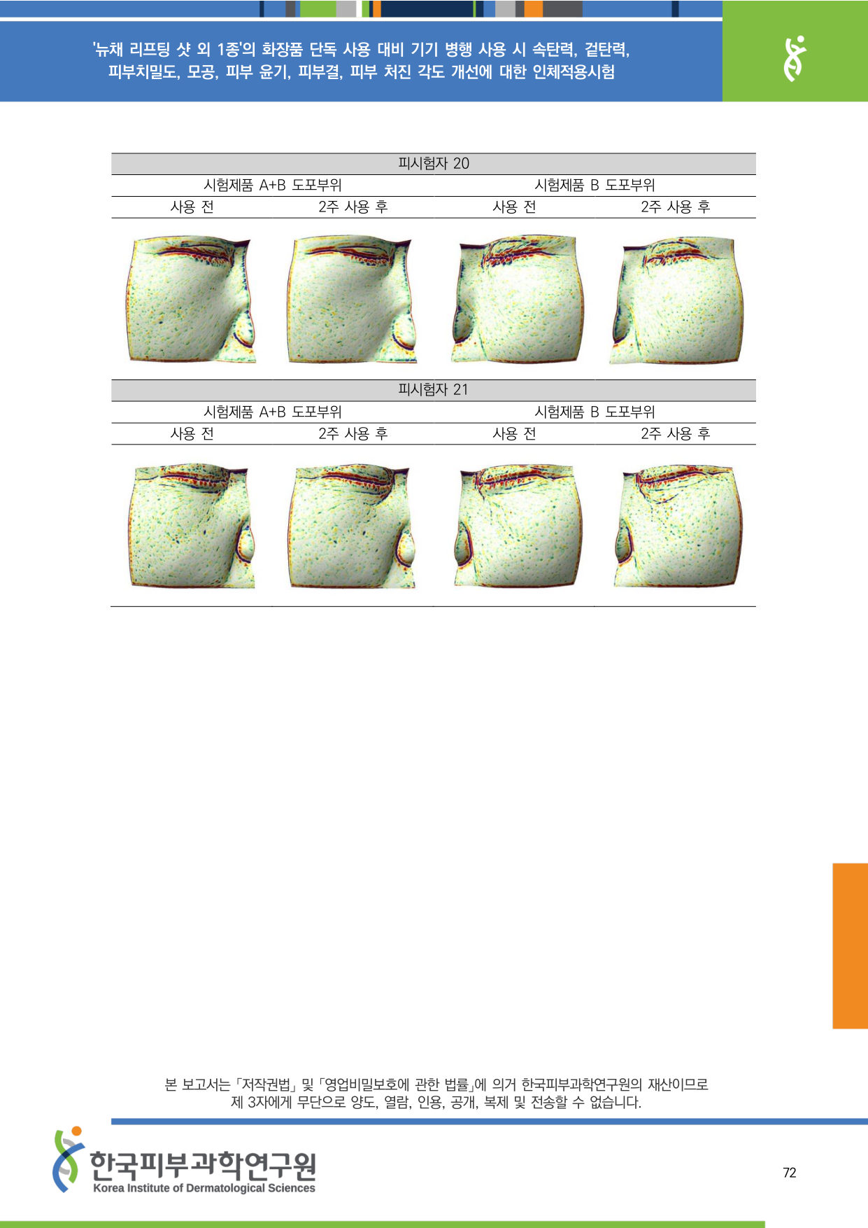 ANTERA 피부결 20-21